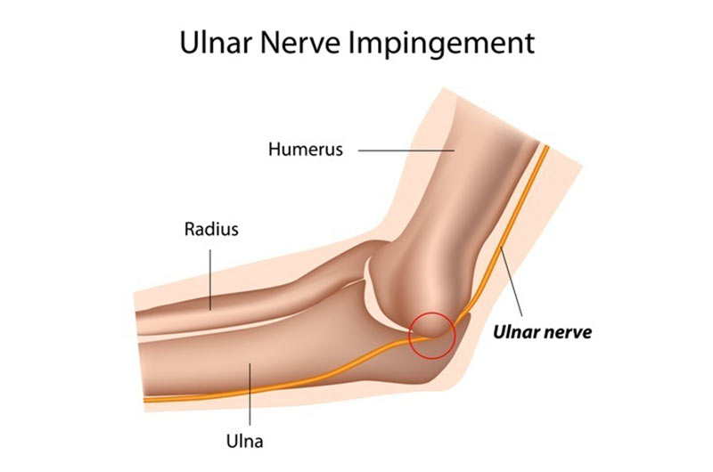 ulnar-sinir-1.jpg